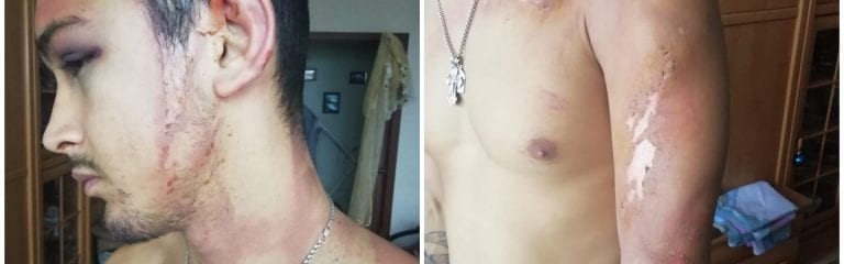 По факту пыток кипятком в Новороссийске возбудили уголовное дело