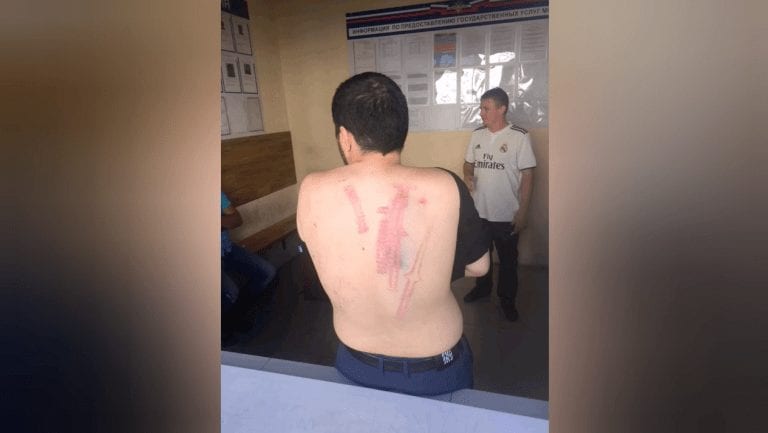 Активист «Сочинской коммуны» рассказал, что его брата и товарищей избили в будке полиции