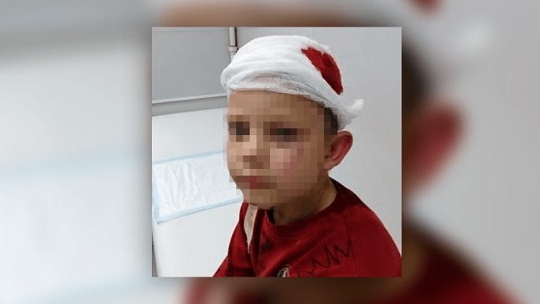 Под Новороссийском бродячая собака набросилась на ребенка