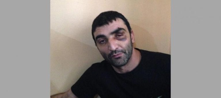 На Кубани прекратили дело по факту избиения подсудимого полицейскими