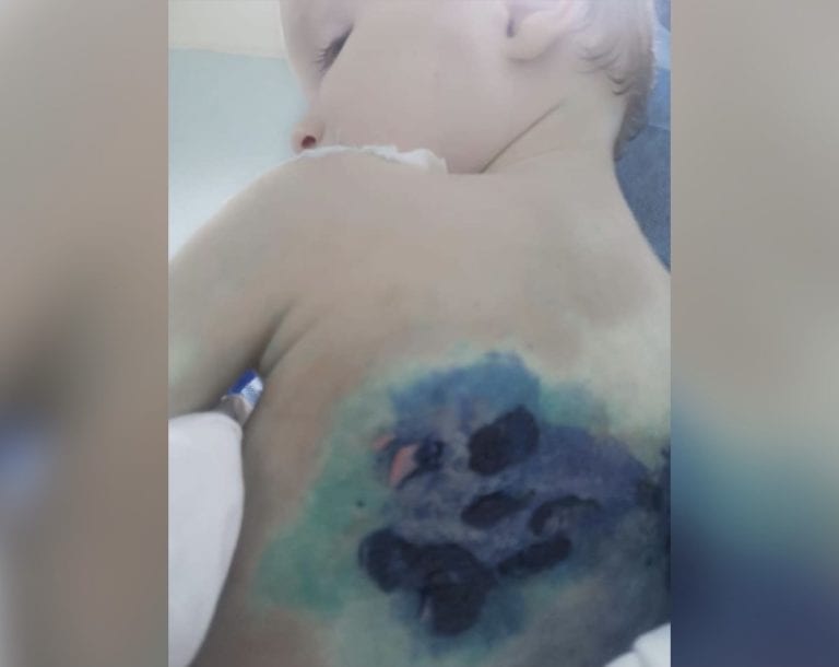 Двухлетний ребёнок получил серьёзные повреждения в больнице Анапы