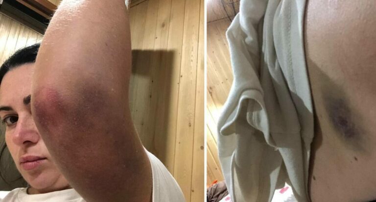 В МВД прокомментировали ситуацию с избиением женщины полицейскими в Сириусе